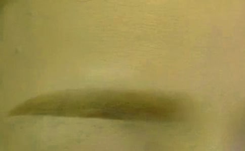 ��дüë��״�ľ���100��