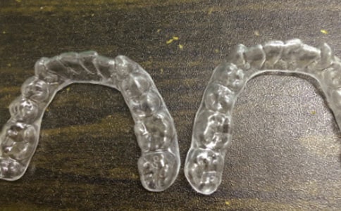 有关上牙套的散文